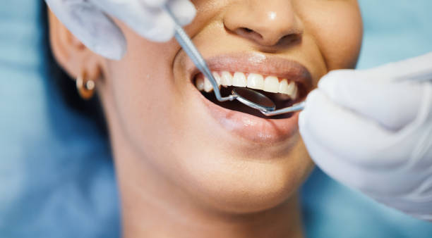 Best Emergency Treatment for Toothache in Spring Ridge, MD