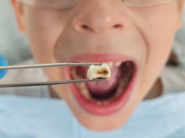 Best Emergency Dental Care for Trauma or Injury in Spring Ridge, MD